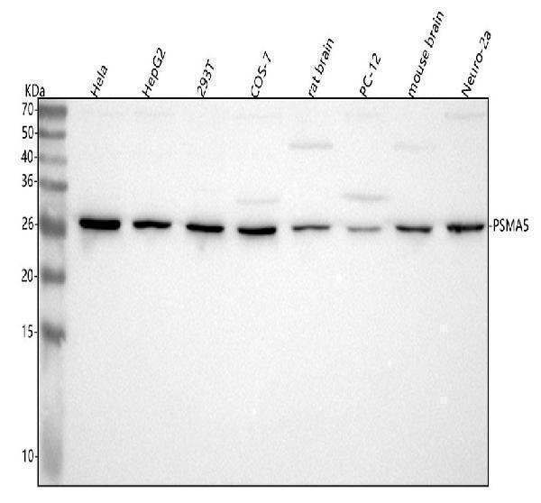  Western blot analysis of PSMA5 using anti-PSMA5 antibody (A07499-1)