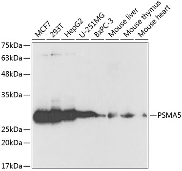 Western blot analysis of extracts of various cell lines, using PSMA5 antibody  at 1:1000 dilution