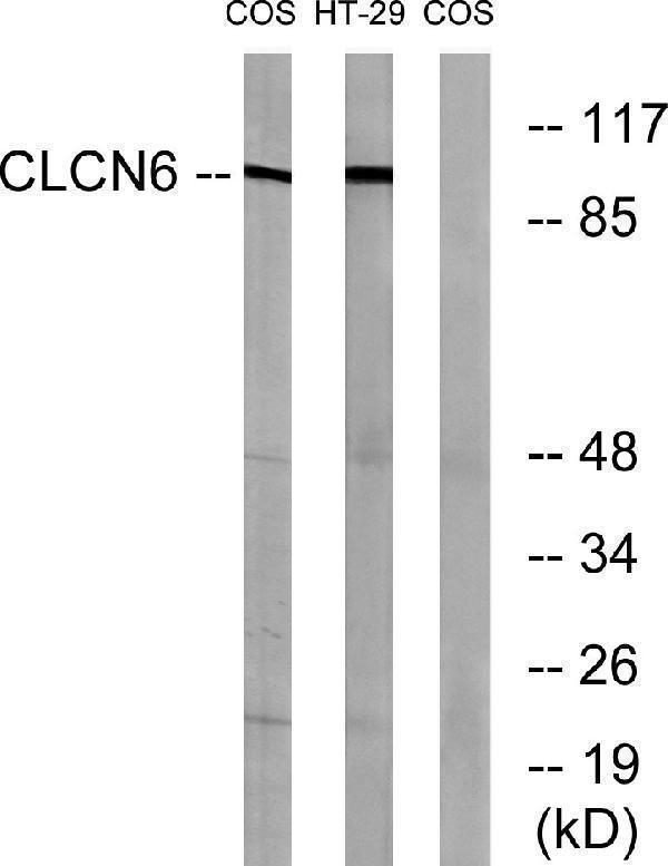 a07500 clcn6 primary antibodies wb testing 1