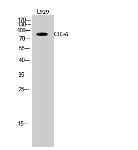 a07500 clcn6 primary antibodies wb testing 3