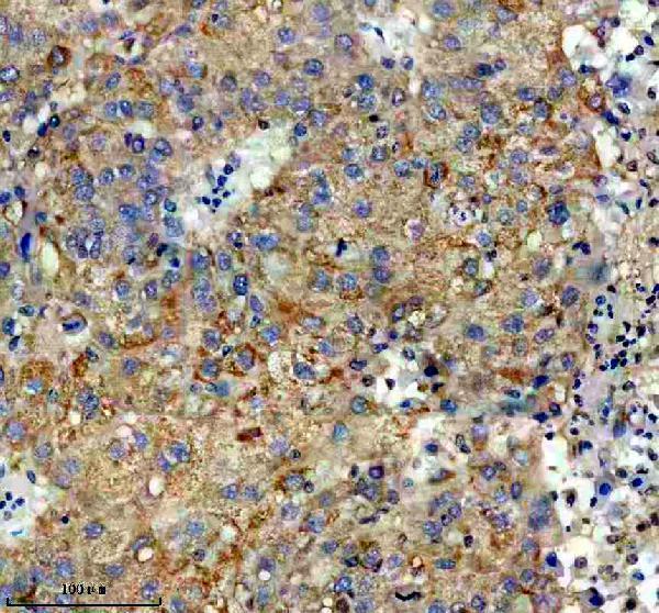 a07501 1 slc17a9 primary antibodies ihc testing 1
