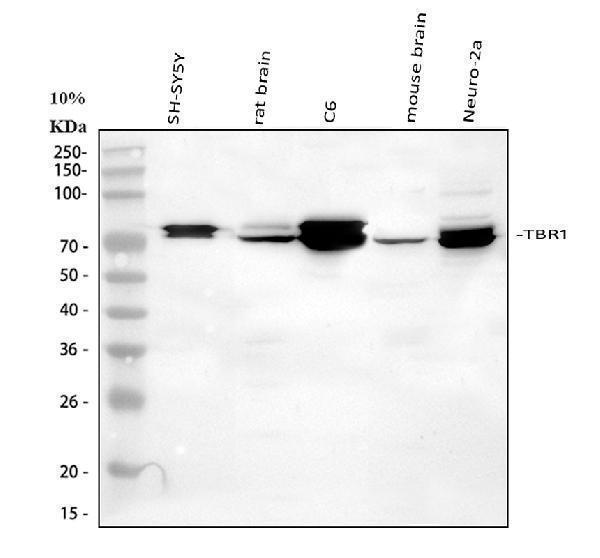  Western blot analysis of TBR1 using anti-TBR1 antibody (A07503-2)