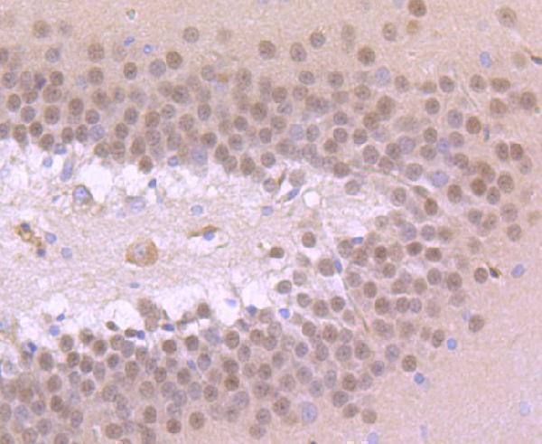 a07503 tbr1 primary antiboties ihc testing 1