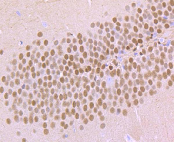 a07503 tbr1 primary antiboties ihc testing 2