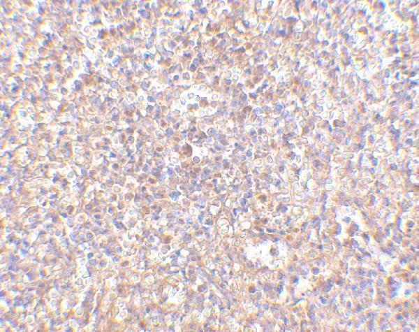 Immunohistochemistry of STEAP1 in human spleen tissue with STEAP1 antibody at 2