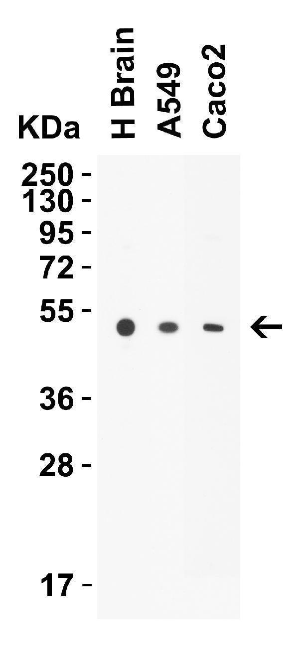 WB Validation in Human
Loading: 10 μg of lysate per lane