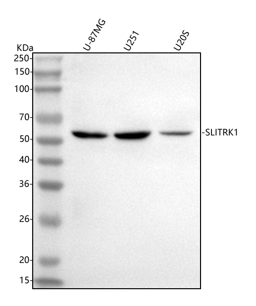  Western blot analysis of SLITRK1 using anti-SLITRK1 antibody (A07507-2)