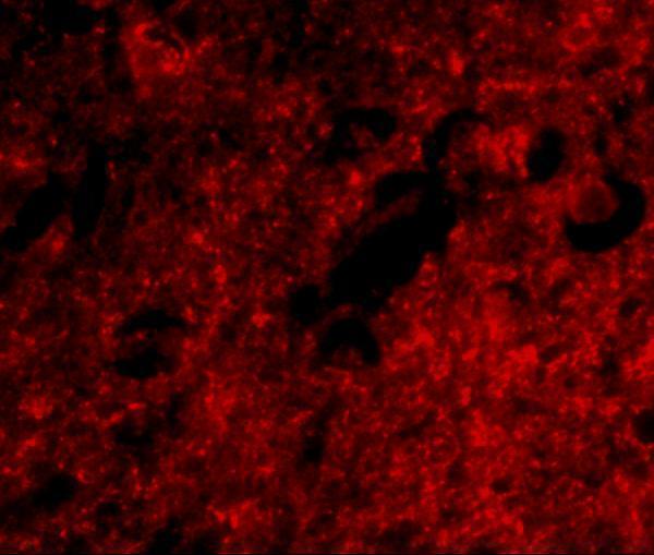 Immunofluorescence of slitrk1 in human brain tissue with slitrk1 antibody at 20 μg/mL