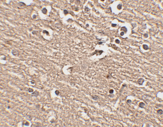 Immunohistochemistry of Slitrk1 in human brain tissue with Slitrk1 antibody at 2