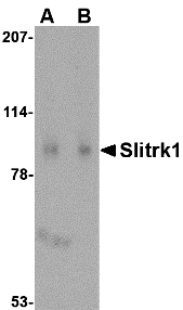 Western blot analysis of Slitrk1 in human brain tissue lysate with Slitrk1 antibody at (A) 1 and (B) 2 μg/mL