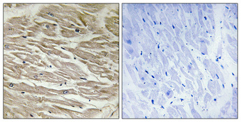a07508 tusc2 primary antibodies ihc testing 1