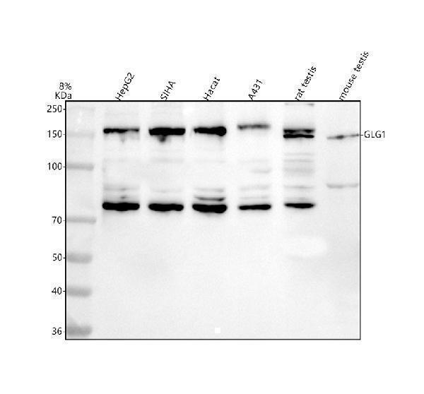  Western blot analysis of GLG1 using anti-GLG1 antibody (A07510-1)