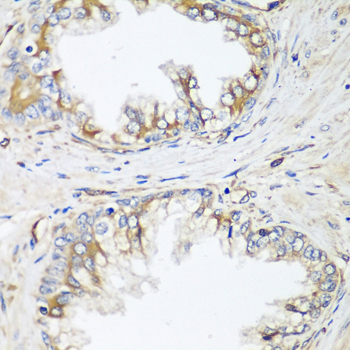 a07511 hpse2 primary antiboties ihc testing 2