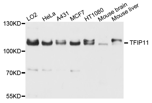 a07513 tfip11 primary antiboties wb testing 1