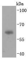 Western blot analysis of IgA on human plasma lysates using anti-IgA antibody at 1/1,000 dilution