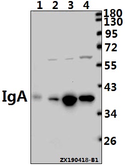 Western blot (WB) analysis of IGHA1/IGHA2 pAb at 1:1000 dilution
Lane1:AML-12 whole cell lysate(40ug)
Lane2:SGC7901 whole cell lysate(40ug)
Lane3:A549 whole cell lysate(40ug)
Lane4:HepG2 whole cell lysate(40ug)