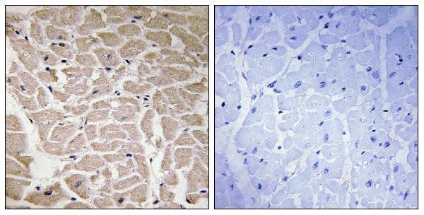 Immunohistochemistry analysis of paraffin-embedded human heart tissue, using Collagen XVI alpha1 Antibody