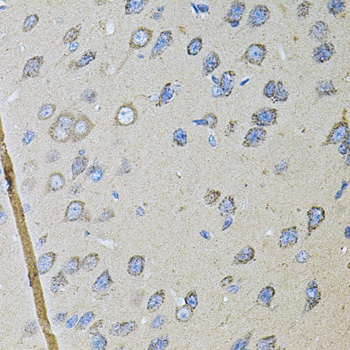 Immunohistochemistry of paraffin-embedded rat kidney using Cadherin 16 antibody  at dilution of 1:100 