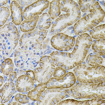 a07518 2 cdh16 primary antiboties ihc testing 3