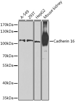 Western blot analysis of extracts of various cell lines, using Cadherin 16 antibody  at 1:1000 dilution