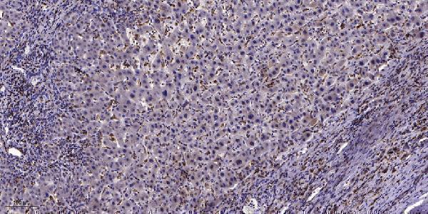 a07518 cdh16 primary antibodies ihc testing 1