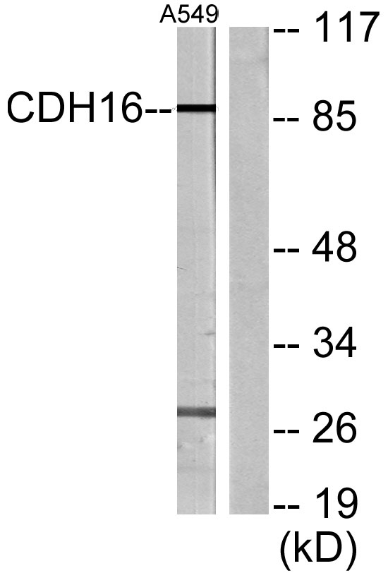 a07518 cdh16 primary antibodies wb testing 4