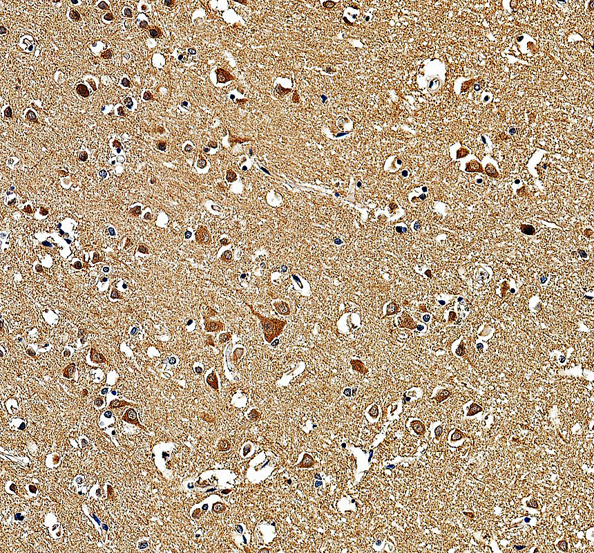 a07519 1 klhl20 primary antibodies ihc testing 1