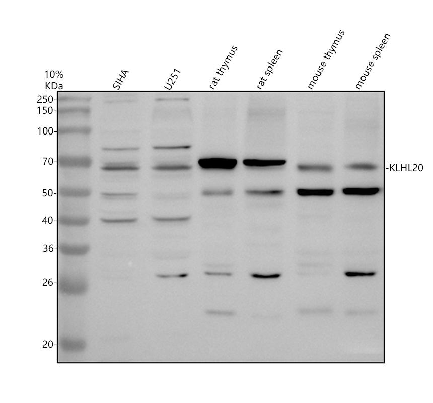 a07519 1 klhl20 primary antibodies wb testing 1
