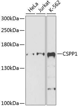 a07521 cspp1 primary antiboties wb testing 1