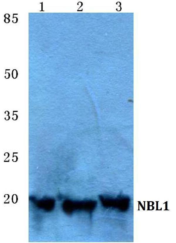 Western blot (WB) analysis of NBL1 polyclonal antibody at 1:500 dilution
Lane1:Jurkat cell lysate
Lane2:Raw264