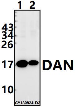 Western blot (WB) analysis of DAN (T161) pAb at 1:500 dilution
Lane1:A549 whole cell lysate(40ug)
Lane2:H1792 whole cell lysate(40ug)
