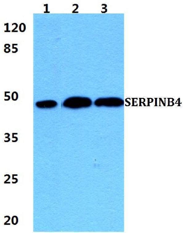 a07524 1 serpinb4 primary antiboties wb testing 1