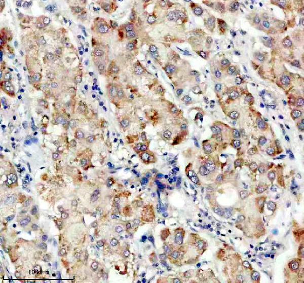 IHC analysis of TDO2 using anti-TDO2 antibody (A07526-2)