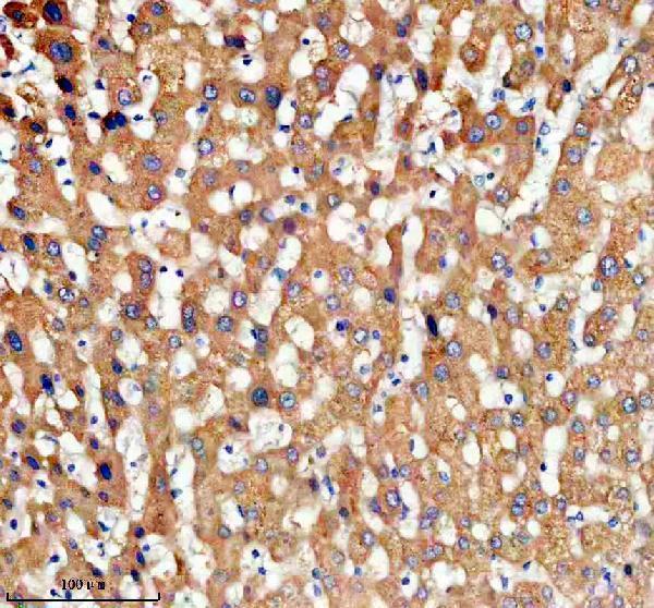 IHC analysis of TDO2 using anti-TDO2 antibody (A07526-2)