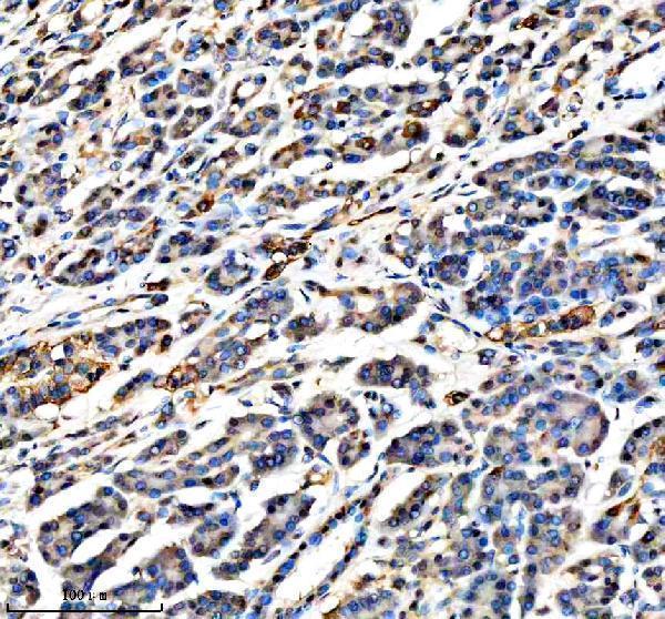 a07527 1 apobec3c primary antibodies ihc testing 3