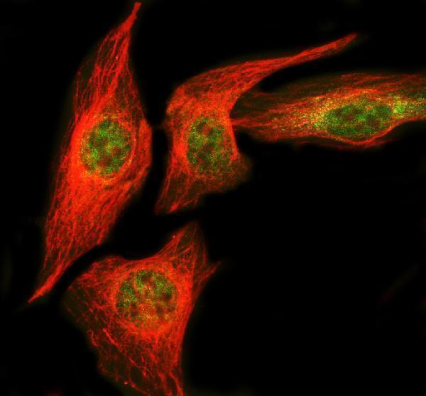 a07530 nudt5 primary antibodies if testing 6