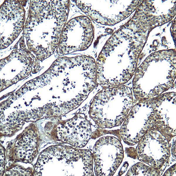 Immunohistochemistry of ADAM29 in human testis tissue with ADAM29 antibody at 5 μg/mL