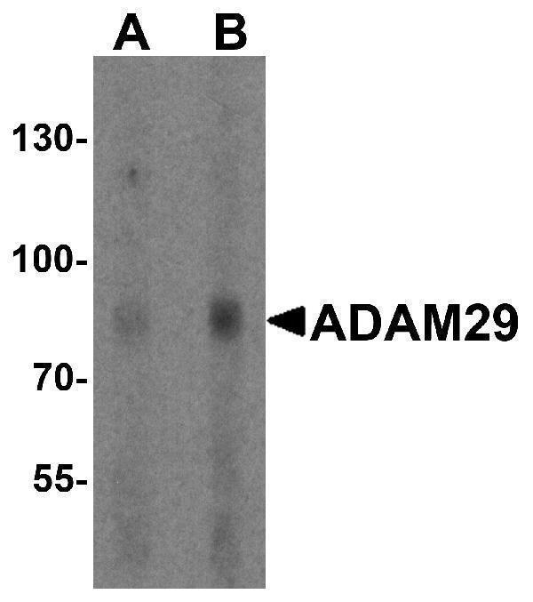 Western blot analysis of ADAM29 in human bladder tissue lysate with ADAM29 antibody at (A) 1 and (B) 2 μg/ml