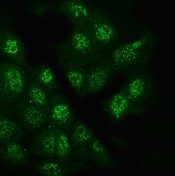 a07532 1 gpc5 primary antibodies if testing 4