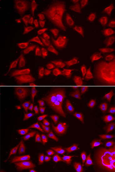 Immunofluorescence analysis of HeLa cell using BLMH antibody
