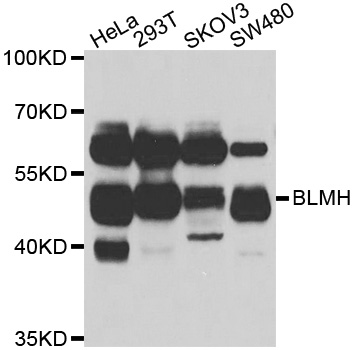 Western blot analysis of extracts of various cell lines, using BLMH antibody