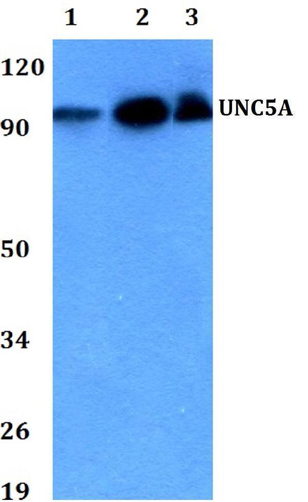 a07537 unc5a primary antiboties wb testing 1