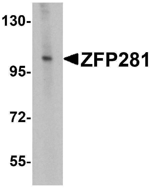 a07538 znf281 primary antibodies wb testing 1
