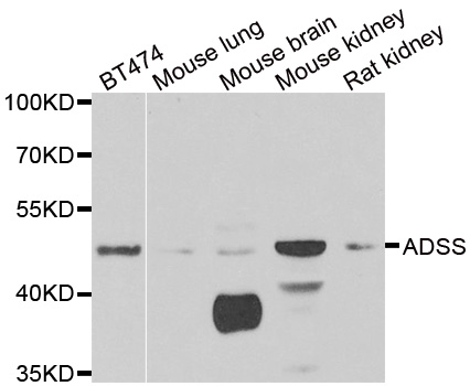 a07539 adss primary antiboties wb testing 1