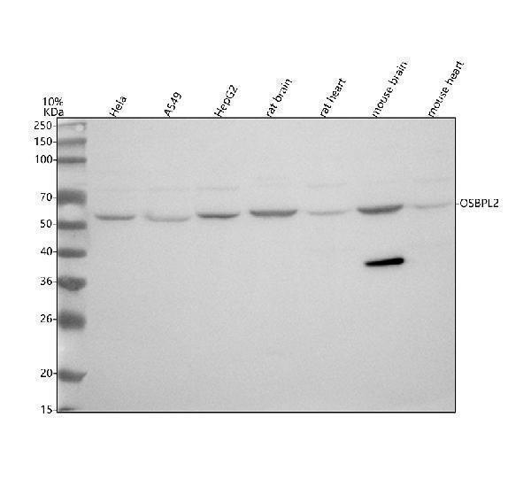  Western blot analysis of OSBPL2 using anti-OSBPL2 antibody (A07543-3)