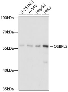 a07543 osbpl2 primary antiboties wb testing 1