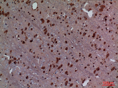 a07544 hoxd3 primary antibodies if testing 3