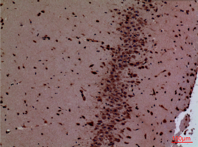 a07544 hoxd3 primary antibodies ihc testing 1