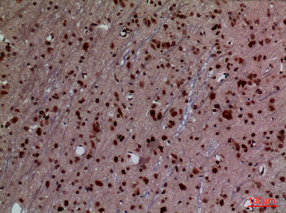 a07544 hoxd3 primary antibodies ihc testing 4