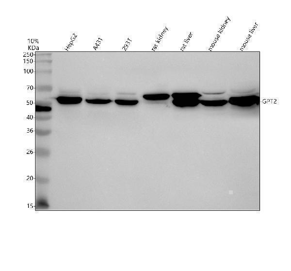 Western blot analysis of GPT2 using anti-GPT2 antibody (A07547-1)